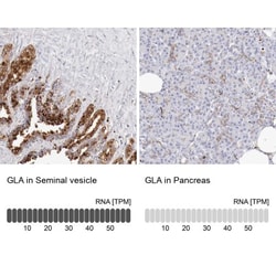 alpha-Galactosidase A/GLA Antibody, Novus Biologicals 0.1mL; Unlabeled:Antibodies,